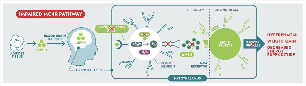 Frame 9397 Diagram illustrating the impaired MC4R pathway. It shows leptin produced by adipose tissue traveling to the hypothalamus but failing to interact with MC4R neurons, leading to hyperphagia, weight gain, and decreased energy expenditure. This is a key mechanism in genetic obesity and other MC4R pathway diseases.